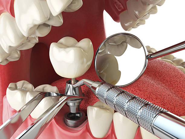 Best Tooth Infection Emergency Dentist  in Roselle, IL